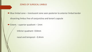 Cornea anatomy simplified | PPTX