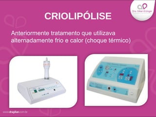 CRIOLIPÓLISE
Anteriormente tratamento que utilizava
alternadamente frio e calor (choque térmico)
 