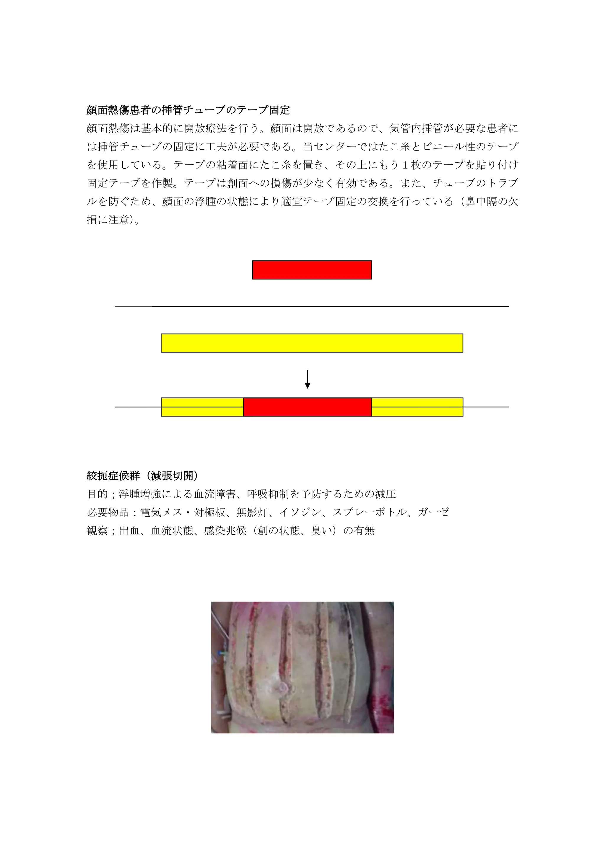 熱傷看護ケアマニュアル | PDF | Lung and Respiratory Health