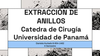 EXTRACCIÓN DE
ANILLOS
Catedra de Cirugía
Universidad de Panamá
Daniela Hurtado 8-954-1462
X Semestre
 