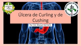 Úlcera de Curling y de
Cushing
Por: Est. Manuel Del Cid S.
 
