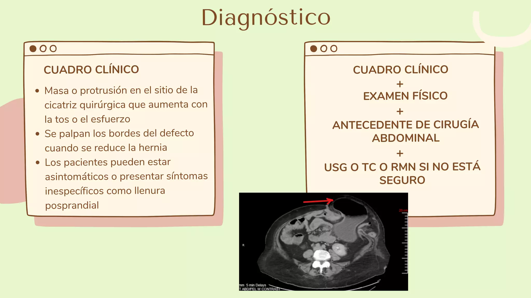 Hernia Ventral Post-Incisional | PPT