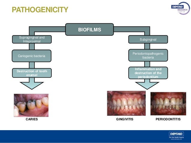 Studying Oral Biofilms