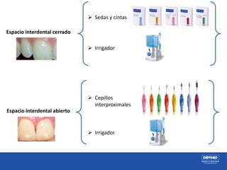 Espacio interdental cerrado
Espacio interdental abierto
 Sedas y cintas
 Cepillos
interproximales
 Irrigador
 Irrigador
 