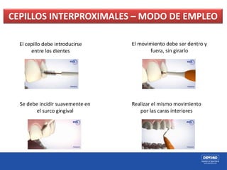 CEPILLOS INTERPROXIMALES – MODO DE EMPLEO
El cepillo debe introducirse
entre los dientes
El movimiento debe ser dentro y
fuera, sin girarlo
Se debe incidir suavemente en
el surco gingival
Realizar el mismo movimiento
por las caras interiores
 
