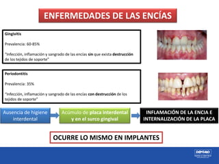 ENFERMEDADES DE LAS ENCÍAS
Gingivitis
Prevalencia: 60-85%
“Infección, inflamación y sangrado de las encías sin que exista destrucción
de los tejidos de soporte”
Periodontitis
Prevalencia: 35%
“Infección, inflamación y sangrado de las encías con destrucción de los
tejidos de soporte”
Ausencia de higiene
interdental
Acúmulo de placa interdental
y en el surco gingival
INFLAMACIÓN DE LA ENCIA E
INTERNALIZACIÓN DE LA PLACA
OCURRE LO MISMO EN IMPLANTES
 