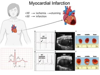Cardiac Inflammation and Repair Following Myocardial Infarction | PDF