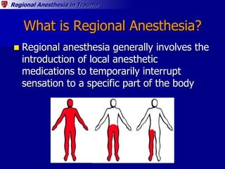 Regional Anesthesia in Trauma
What is Regional Anesthesia?
 Regional anesthesia generally involves the
introduction of lo...