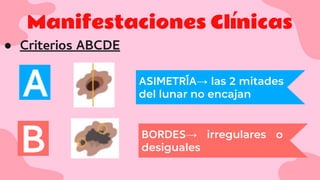 Manifestaciones Clínicas
● Criterios ABCDE
A
B
ASIMETRÍA→ las 2 mitades
del lunar no encajan
BORDES→ irregulares o
desiguales
 