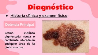 Diagnóstico
● Historia clínica y examen físico
Dolencia Principal
Lesión cutánea
pigmentada nueva o
cambiante, ubicada en
cualquier área de la
piel o mucosa.
 