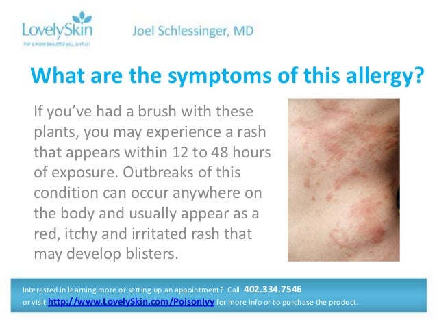 Joel Schlessinger Md Faq Poison Ivy Rashes