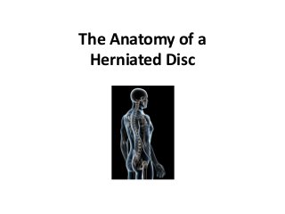 The Anatomy of a
 Herniated Disc
 