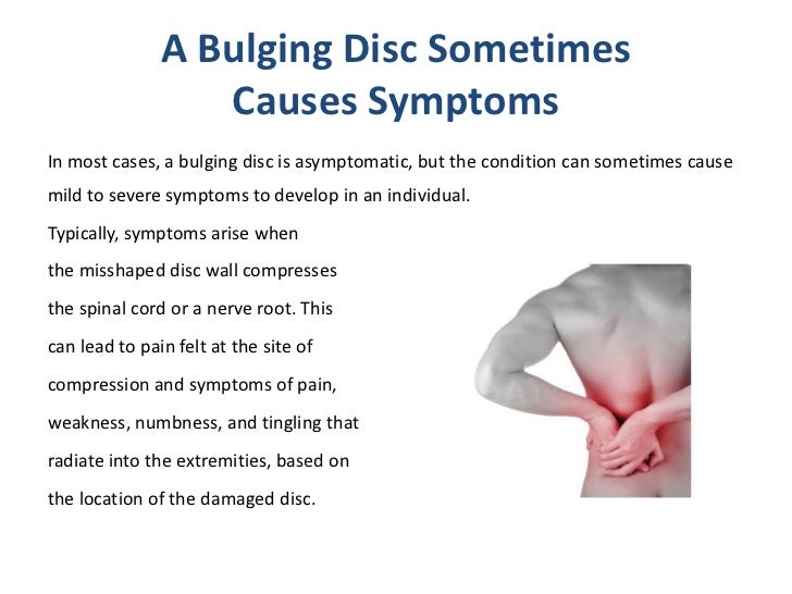 Exploring Bulging Disc Causes