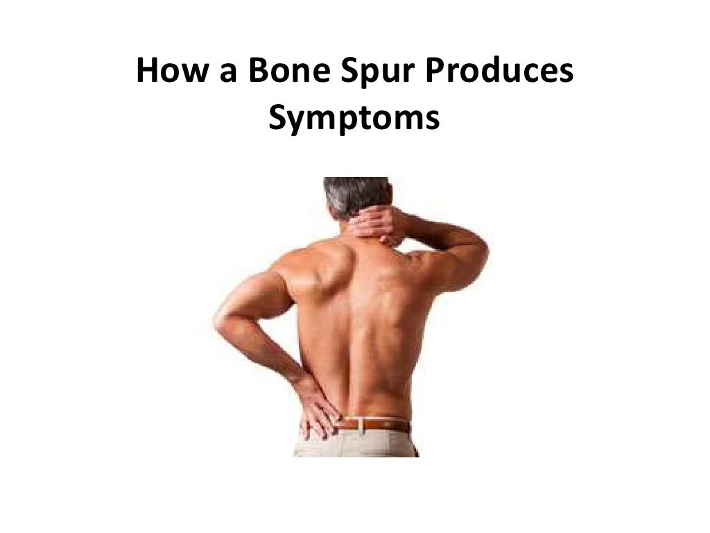 Bone Spur Symptoms