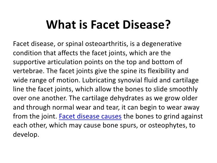 what is facet
