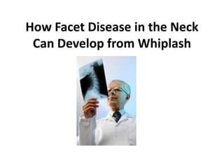 How Facet Disease in the Neck
 Can Develop from Whiplash
 
