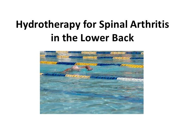 Spinal Arthritis in the Lower Back & Hydrotherapy
