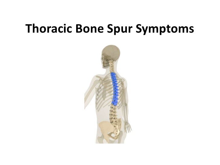 Thoracic Bone Spur Symptoms