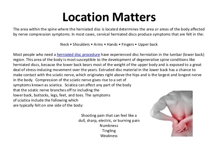 Herniated Disc Procedure