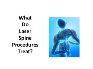 What
    Do
   Laser
   Spine
Procedures
  Treat?
 