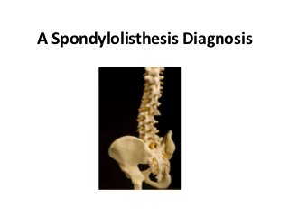 A Spondylolisthesis Diagnosis
 