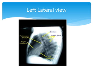 Viewing chest x ray | PPTX