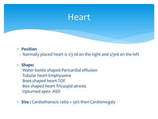 Viewing chest x ray | PPTX