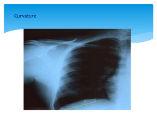 Viewing chest x ray | PPTX