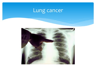 Viewing chest x ray | PPTX