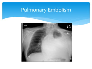 Viewing chest x ray | PPTX
