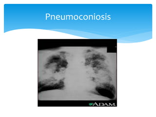 Viewing chest x ray | PPTX
