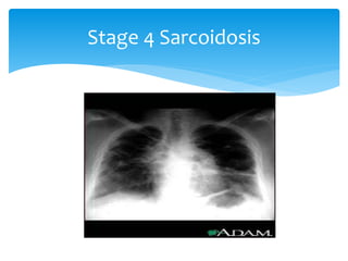 Viewing chest x ray | PPTX