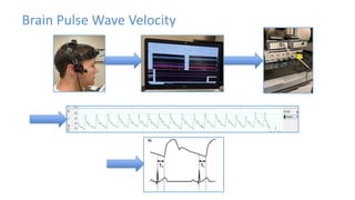 Pulse Wave Velocity: Theory, Applications, Methods, and Future ...