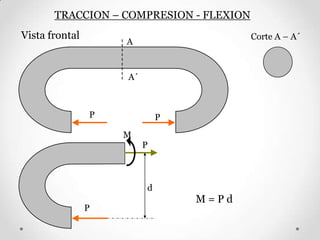 P P
A
A´
Corte A – A´Vista frontal
P
P
d
M
M = P d
TRACCION – COMPRESION - FLEXION
 