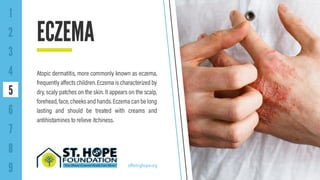 9 Common Skin Disorders