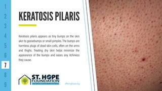 9 Common Skin Disorders