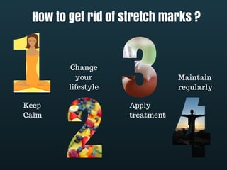 How to get rid of stretch marks ? 
Keep 
Calm 
Change 
your 
lifestyle 
Apply 
treatment 
Maintain 
regularly 
 