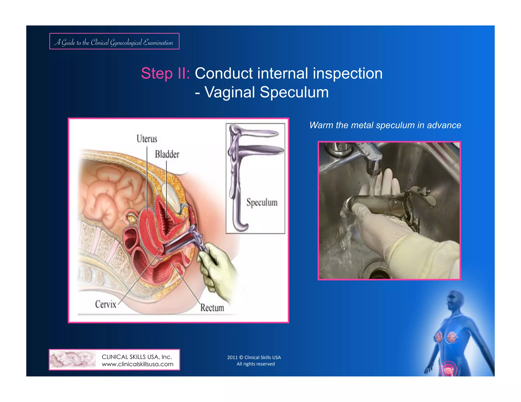 A Guide to the Clinical Gynecological Exam as Instructed by a Female ...