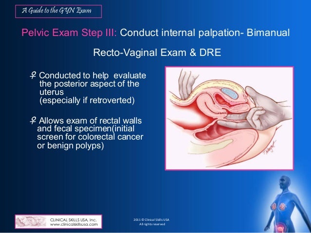 A Guide to the Clinical Gynecological Exam as Instructed by a Female