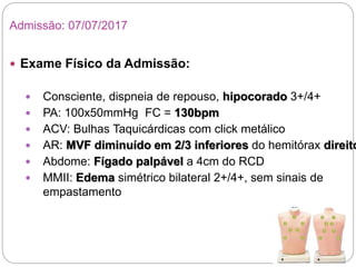 Admissão: 07/07/2017
 Exame Físico da Admissão:
 Consciente, dispneia de repouso, hipocorado 3+/4+
 PA: 100x50mmHg FC = 130bpm
 ACV: Bulhas Taquicárdicas com click metálico
 AR: MVF diminuído em 2/3 inferiores do hemitórax direito
 Abdome: Fígado palpável a 4cm do RCD
 MMII: Edema simétrico bilateral 2+/4+, sem sinais de
empastamento
 