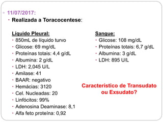 ▫ 11/07/2017:
 Realizada a Toracocentese:
Líquido Pleural:
 850mL de líquido turvo
 Glicose: 69 mg/dL
 Proteínas totais: 4,4 g/dL
 Albumina: 2 g/dL
 LDH: 2,045 U/L
 Amilase: 41
 BAAR: negativo
 Hemácias: 3120
 Cel. Nucleadas: 20
 Linfócitos: 99%
 Adenosina Deaminase: 8,1
 Alfa feto proteína: 0,92
Sangue:
 Glicose: 108 mg/dL
 Proteínas totais: 6,7 g/dL
 Albumina: 3 g/dL
 LDH: 895 U/L
Característico de Transudato
ou Exsudato?
 