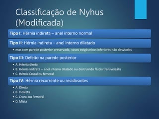 Classificação de Nyhus
(Modificada)
Tipo I: Hérnia indireta – anel interno normal
Tipo II: Hérnia indireta – anel interno dilatado
• mas com parede posterior preservada, vasos epigástricos inferiores não desviados
Tipo III: Defeito na parede posterior
• A. Hérnia direta
• B. Hérnia indireta – anel interno dilatado ou destruindo fáscia transversális
• C. Hérnia Crural ou femoral
Tipo IV: Hérnia recorrente ou recidivantes
• A. Direta
• B. Indireta
• C. Crural ou Femoral
• D. Mista
 