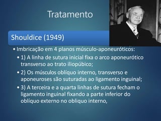 Tratamento
Shouldice (1949)
• Imbricação em 4 planos músculo-aponeuróticos:
• 1) A linha de sutura inicial fixa o arco aponeurótico
transverso ao trato iliopúbico;
• 2) Os músculos oblíquo interno, transverso e
aponeuroses são suturadas ao ligamento inguinal;
• 3) A terceira e a quarta linhas de sutura fecham o
ligamento inguinal fixando a parte inferior do
oblíquo externo no obliquo interno,
 