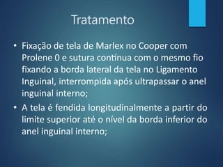 Tratamento
• Fixação de tela de Marlex no Cooper com
Prolene 0 e sutura contínua com o mesmo fio
fixando a borda lateral da tela no Ligamento
Inguinal, interrompida após ultrapassar o anel
inguinal interno;
• A tela é fendida longitudinalmente a partir do
limite superior até o nível da borda inferior do
anel inguinal interno;
 