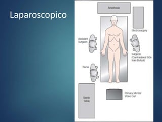 Laparoscopico
 