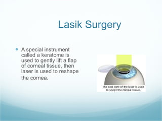 Lasik Surgery A special instrument called a keratome is used to gently lift a flap of corneal tissue, then laser is used to reshape the cornea.     
