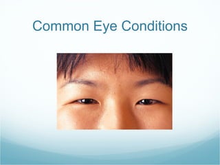 Common Eye Conditions 