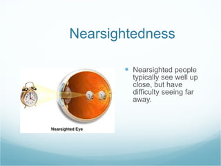 Nearsightedness Nearsighted people typically see well up close, but have difficulty seeing far away. 