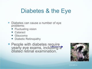 Diabetes & the Eye Diabetes can cause a number of eye problems: Fluctuating vision  Cataract Glaucoma Diabetic Retinopathy People with diabetes require yearly eye exams, including a dilated retinal examination. www.opto.ca 