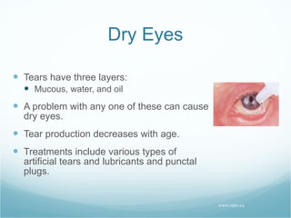 Dry Eyes Tears have three layers: Mucous, water, and oil A problem with any one of these can cause dry eyes. Tear production decreases with age. Treatments include various types of artificial tears and lubricants and punctal plugs. www.opto.ca 